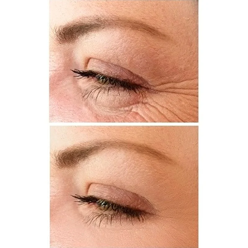 No.1 Lift Crème contour des yeux 15 ml