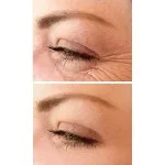 No.1 Lift Crème contour des yeux 15 ml