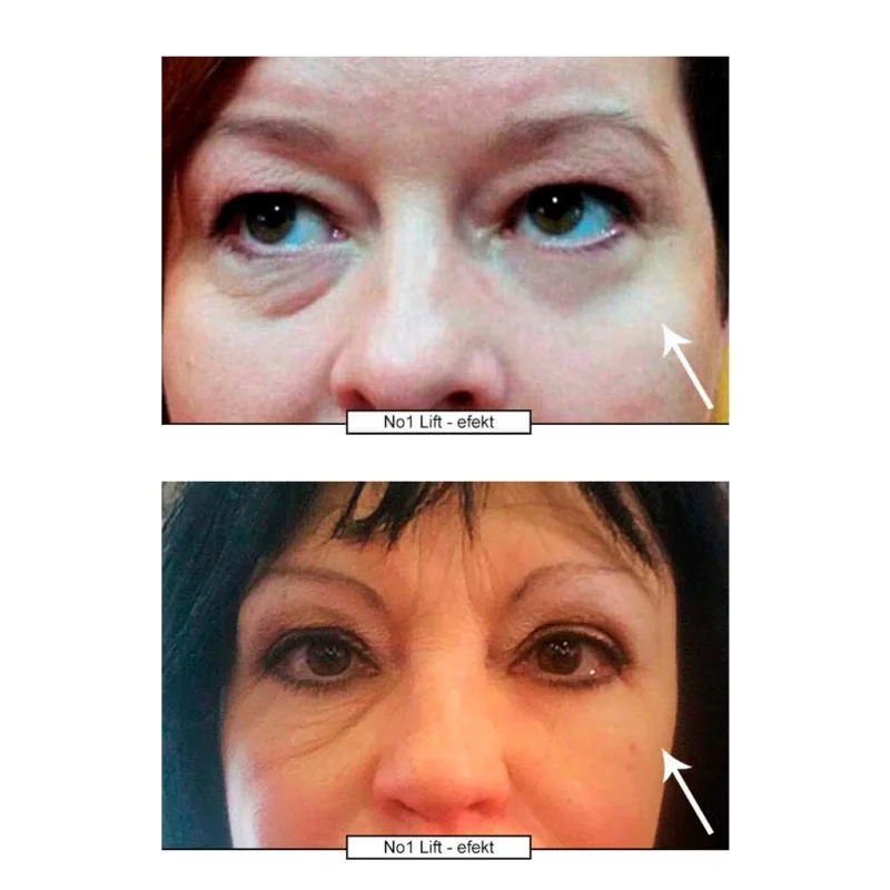 No.1 Lift Crème contour des yeux 15 ml